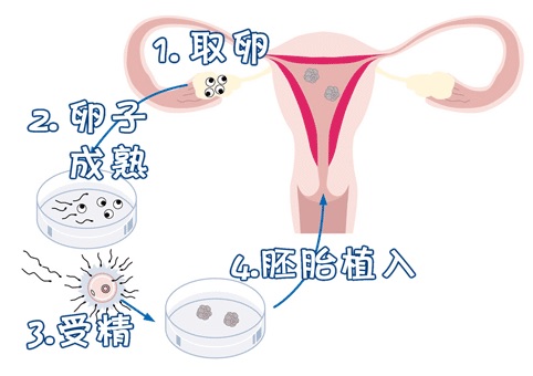 孕妈代妈应聘机构